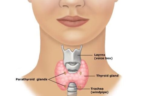 noduli tiroidieni